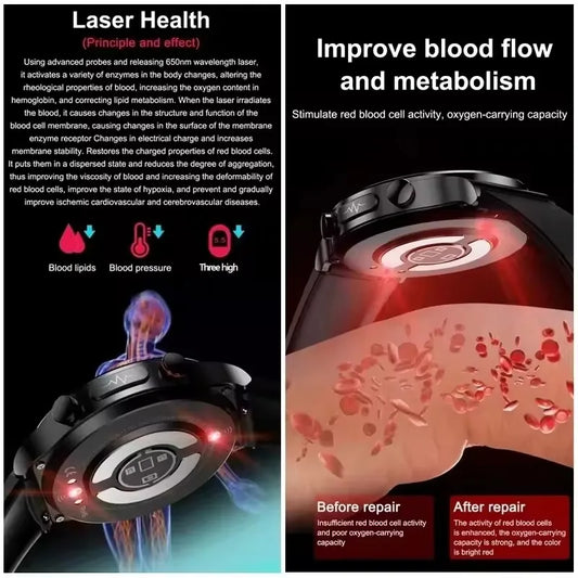 2025New Laser Therapy ECG+PPG Smartwatch For Men Women Sapphire Glass Screen Heart Rate Blood Lipid Uric Acid Health Smart Watch