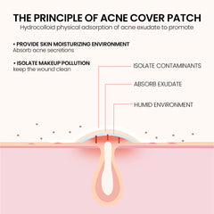 Pimple Patches Deep Clean Gentle Non-irritating Facial Treatment Acne Removal Waterproof Beauty Skincare Concealer Pimple Marks