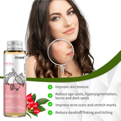 Seed Oil, 100% Pure Organic Unrefined Cold Pressed Anti Aging Rose Hip Moisturizer For Hair Skin & Nails