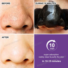 Blackhead Remover Face Mask Cream Oil-Control Nose Black Dots Mask Deep Cleansing Pore Nose Men Women Beauty Cosmetics Skin Care