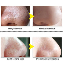 Blackhead Remover Cream Tearing Mask Set Plant Nose Pore Strips Acne Treatment Black Dots Peel Off Mud Mask Skin Care