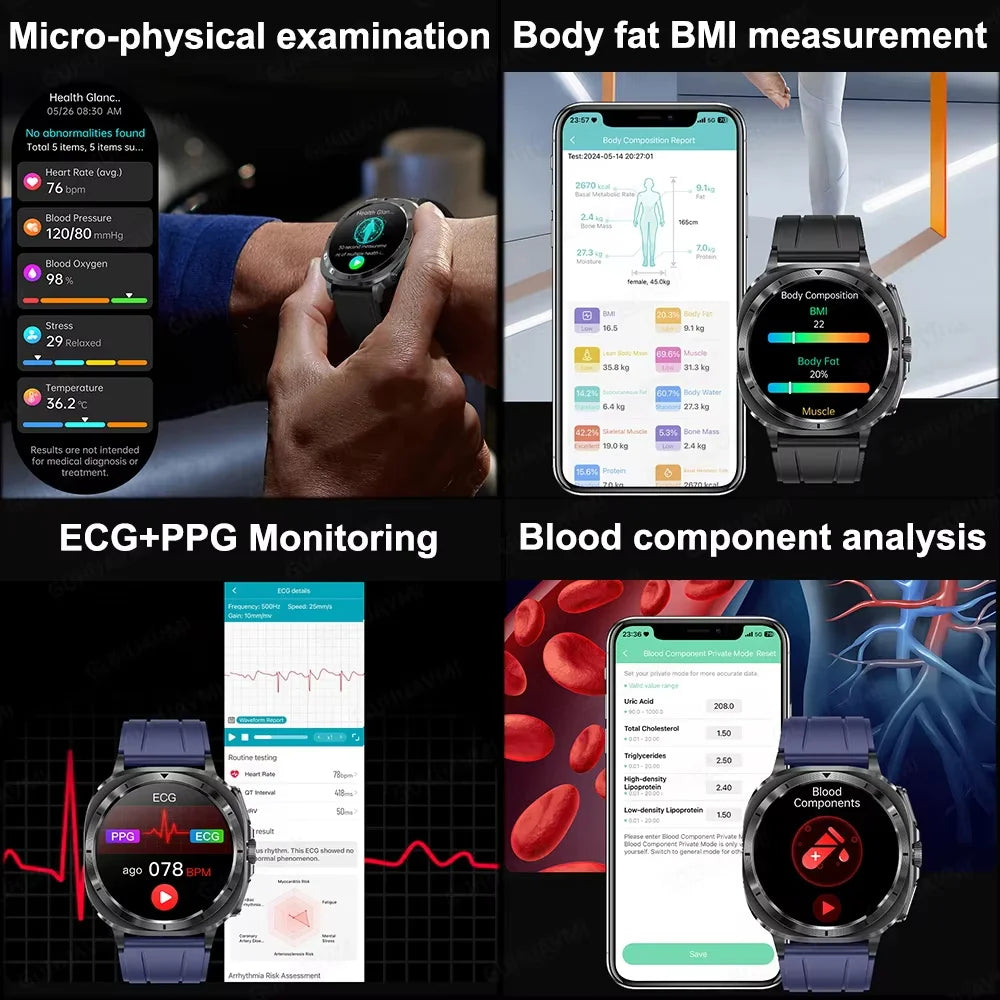 2025 Fashion New Expert level Health Smart Watch Men ECG+PPG Laser Monitor Uric Acid Blood Fat Blood Pressure NFC HD Call Watch