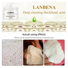 Blackhead Remover Cream Tearing Mask Set Plant Nose Pore Strips Acne Treatment Black Dots Peel Off Mud Mask Skin Care