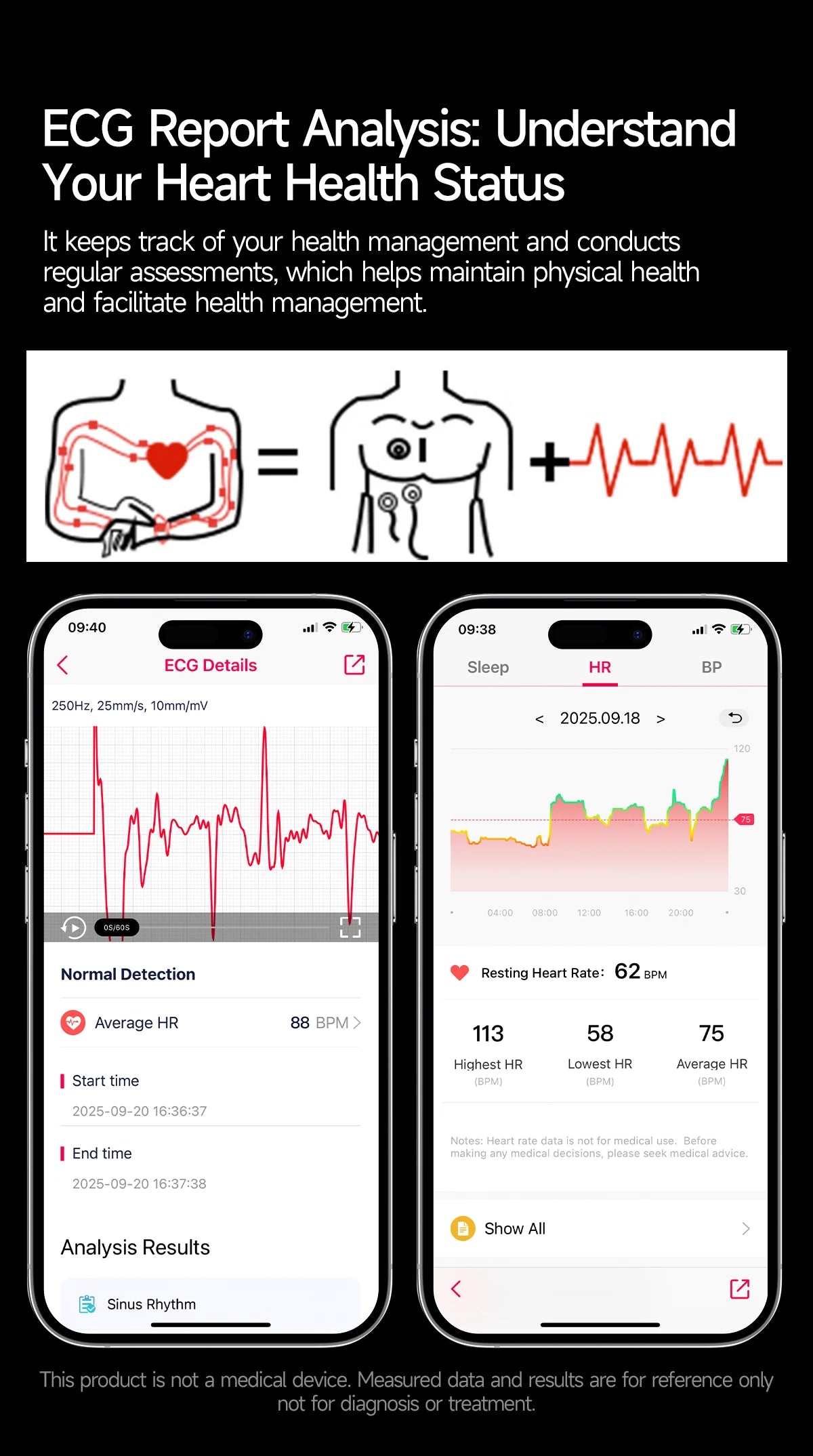 New Upgraded Health Monitoring Uric Acid Blood Pressure Blood Oxygen Heart Health Check Smart Watch ECG smart watches Man 2025