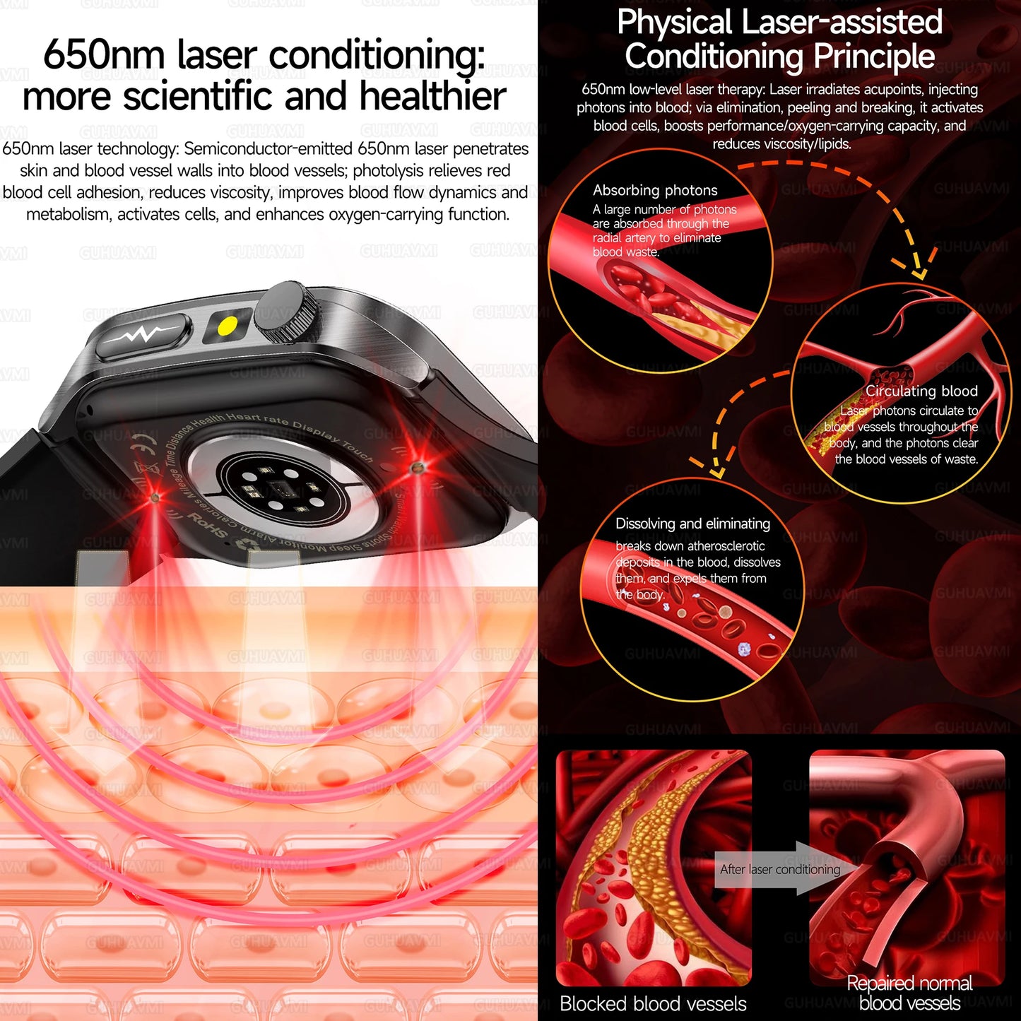 2025 Laser Treatment Three High SmartWatch 1.95" Sapphire Curved Screen ECG+PPG Blood fat Uric Acid Health Diagnosis Smartwatch