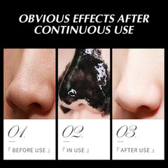 Blackhead Remover Mask Nasal Patch Deep Cleaning Skin Care Shrink Pores Acne Treatment Nose Mask Black Dot Pores Clean Strip