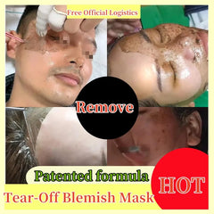 Peel off instant Freckle Removal Mask Effective treatment Chloasma Pigmentation Acne Scars Dark Spots Facial Skin Care Products