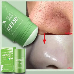 Original Facial Remove Blackhead Green Tea Solid Mask Treat Acne Blemish Black Dots Clean Stick Cream Shrink Pores Skin Care ﻿