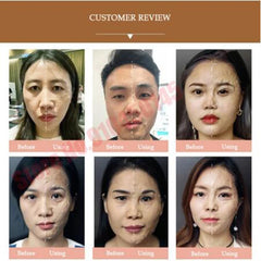 3D Hifu Hanacure Mask Facial Mask Therapy V Face Facial Lift Anti-aging Reducing Pores Fade Fine Line Korean Cosmetics