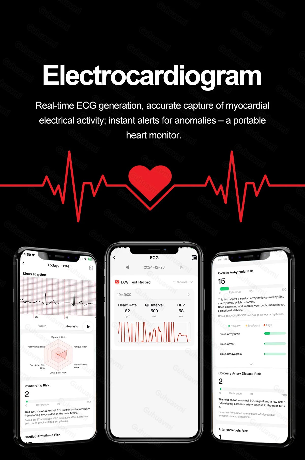 Smartwatch  AMOLED Screen Call ECG Sport Watchs