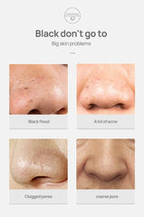 Blackhead-removing Nasal Membrane Pore-shrinking Facial Cleaning Products Mild Oil Control And Oil Absorption Nose Patch