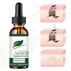 Natural Tea Tree Oil Moisturizer Face Body Skin Care For Women Hair Care Fragrance Aromatherapy Pure Massage Essential Oil