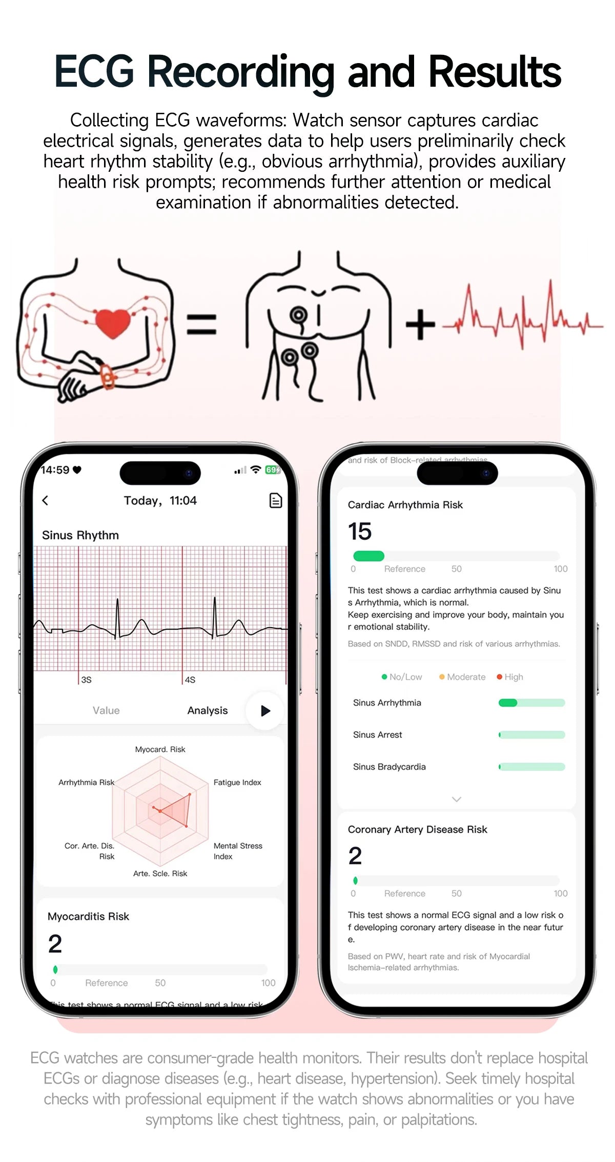 Body Composition analysis Monitoring Smart Watch Men ECG Heart Rate Blood pressure Uric Acid Health Tracker Smartwatches 2026New