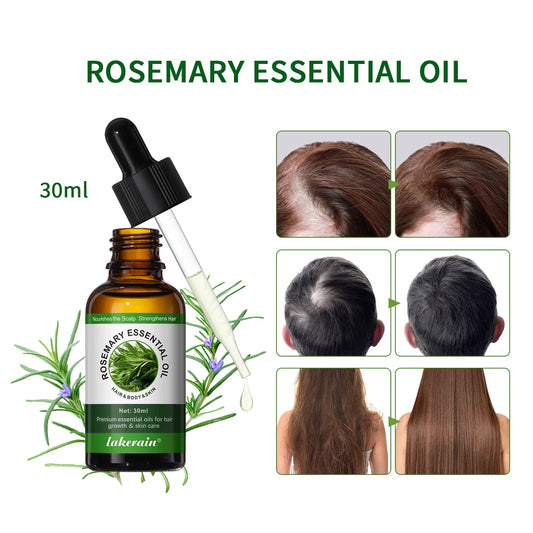 30ml Natural Essential Oils Plant Extract Serum Massage Oil For Hair Skin Body Relax Black Seed Oil Rosemary Oil 1 Bottle